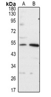 FOXP3 Rabbit Polyclonal Antibody