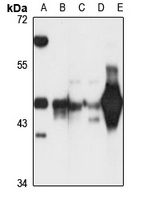 Septin 5 Rabbit Polyclonal Antibody