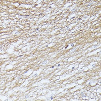Septin 5 Rabbit Polyclonal Antibody