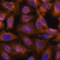 Septin 5 Rabbit Polyclonal Antibody