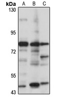 ABCG4 Rabbit Polyclonal Antibody
