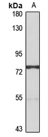 ABCG5 Rabbit Polyclonal Antibody
