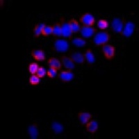 ABCG8 Rabbit Polyclonal Antibody