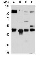 ACTR6 Rabbit Polyclonal Antibody