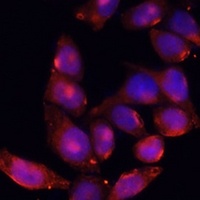 ACVR2B Rabbit Polyclonal Antibody