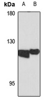 ADAMTS2 Rabbit Polyclonal Antibody