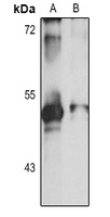 APOBEC3F Rabbit Polyclonal Antibody