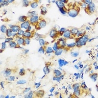 APOBEC3F Rabbit Polyclonal Antibody