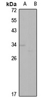Apolipoprotein D Rabbit Polyclonal Antibody