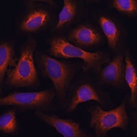 ARFGAP2 Rabbit Polyclonal Antibody