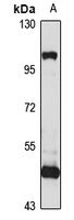 ARL13B Rabbit Polyclonal Antibody
