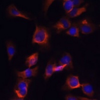 ARL13B Rabbit Polyclonal Antibody
