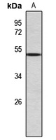 ASMT Rabbit Polyclonal Antibody