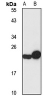 PUMA Rabbit Polyclonal Antibody