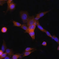 PUMA Rabbit Polyclonal Antibody