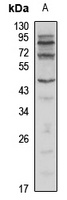 BCL2L13 Rabbit Polyclonal Antibody