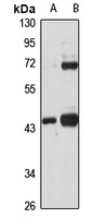 BDH1 Rabbit Polyclonal Antibody