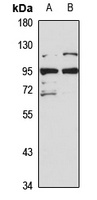 BRAT1 Rabbit Polyclonal Antibody