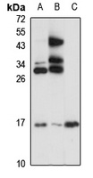 IL-25 Rabbit Polyclonal Antibody