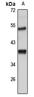 CTRP4 Rabbit Polyclonal Antibody