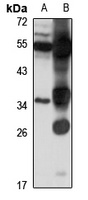 GPR77 Rabbit Polyclonal Antibody
