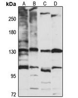 TIP120A Rabbit Polyclonal Antibody