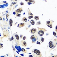 TIP120A Rabbit Polyclonal Antibody