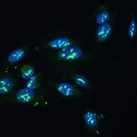 CCDC59 Rabbit Polyclonal Antibody