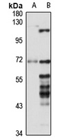 CCDC6 Rabbit Polyclonal Antibody