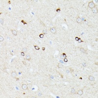 CCDC6 Rabbit Polyclonal Antibody