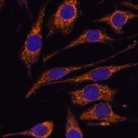 CCDC6 Rabbit Polyclonal Antibody