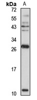 CCL19 Rabbit Polyclonal Antibody