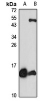 CCL20 Rabbit Polyclonal Antibody