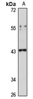 CCR7 Rabbit Polyclonal Antibody