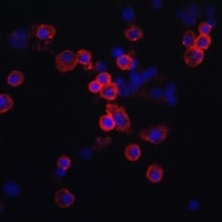 CCR7 Rabbit Polyclonal Antibody