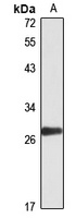 CD320 Rabbit Polyclonal Antibody
