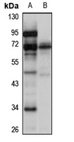 CAST Rabbit Polyclonal Antibody