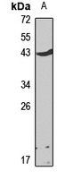 CD79a Rabbit Polyclonal Antibody