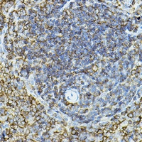 CD79a Rabbit Polyclonal Antibody