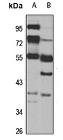 CDK16 Rabbit Polyclonal Antibody