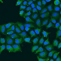 CDK16 Rabbit Polyclonal Antibody