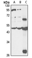 CDKAL1 Rabbit Polyclonal Antibody