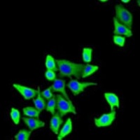 CDKAL1 Rabbit Polyclonal Antibody