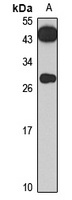 CENPQ Rabbit Polyclonal Antibody