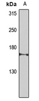 CEP164 Rabbit Polyclonal Antibody