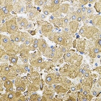 CEP164 Rabbit Polyclonal Antibody
