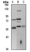 Ceramide Kinase Rabbit Polyclonal Antibody