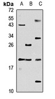 CGB7 Rabbit Polyclonal Antibody