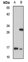 CHCHD2 Rabbit Polyclonal Antibody