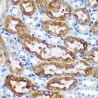 CHCHD2 Rabbit Polyclonal Antibody